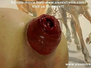 Anal Prolapse Movies - Hot Anal prolapse XXX - ATUBE.XXX